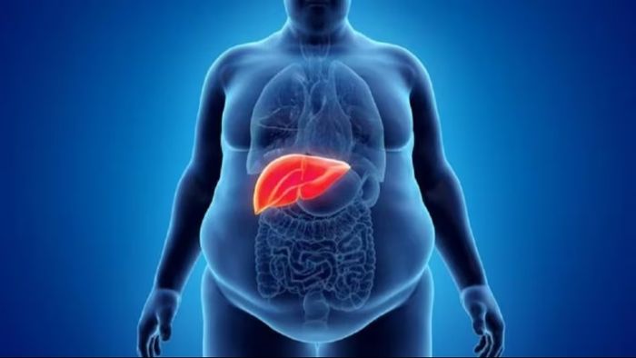 সাধারণ কয়েকটি জিনিসেই বেয়ারা ফ্যাটি লিভারকে নিয়ন্ত্রণে রাখুন