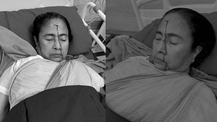 আহত মমতা বন্দ্যোপাধ্যায়। ফাইল ছবি