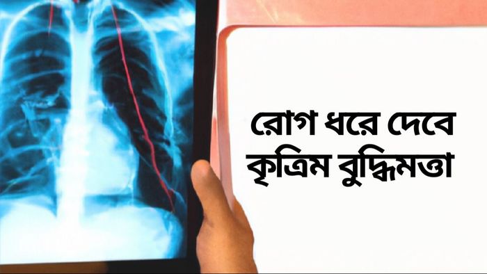 এক্স রে দেখে রোগ ধরে দেবে আর্টিফিসিয়াল ইন্টেলিজেন্স