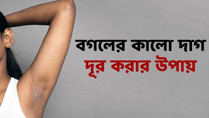 প্রতীকী ছবি