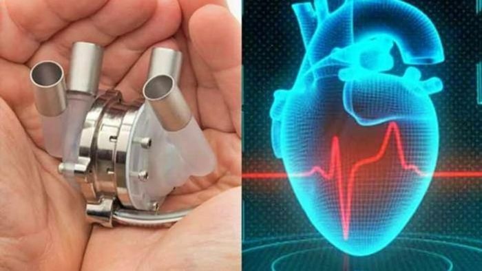 কৃত্রিম হার্ট। ফাইল ছবি
