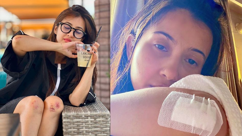 জাপানে দুর্ঘটনার কবলে মনামী, একেবারে রক্তারক্তি অবস্থা! এখন কেমন আছেন?   জাপানে দুর্ঘটনার কবলে মনামী, একেবারে রক্তারক্তি অবস্থা! এখন কেমন আছেন?