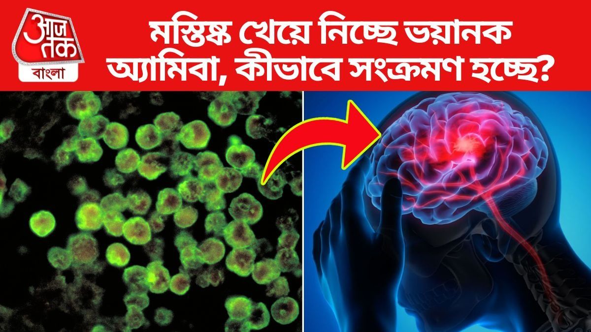 Brain Eating Ameoba 