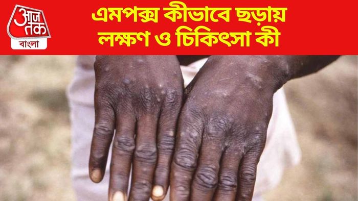 এবার পাকিস্তানেও Mpox Virus-এ আক্রান্ত ৩ জন, কীভাবে সতর্ক থাকবেন?