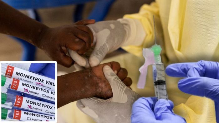 এমপক্স-এর ভ্যাকসিন তৈরি করবে সিরাম ইনস্টিটিউট।