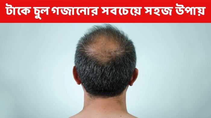 প্রতীকী ছবি