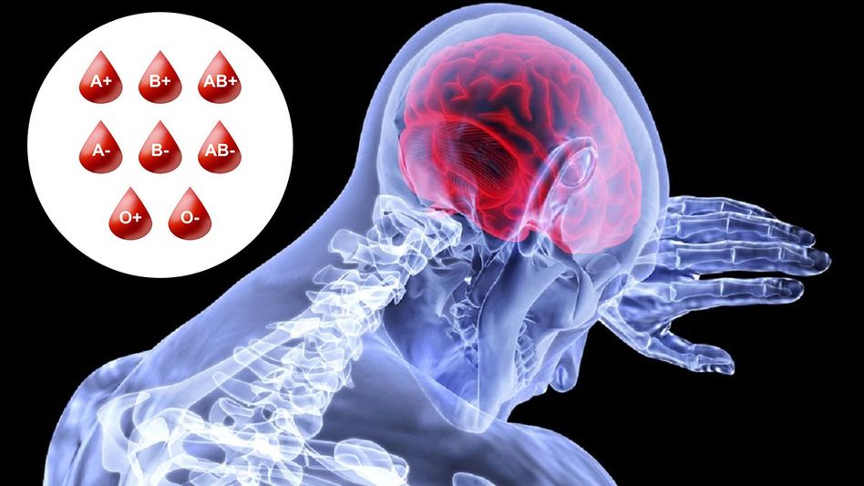 কোন ব্লাড গ্রুপের মানুষদের স্ট্রোকের ঝুঁকি বেশি, কারা রয়েছেন সেফ জোনে? কোন ব্লাড গ্রুপের মানুষদের স্ট্রোকের ঝুঁকি বেশি, কারা রয়েছেন সেফ জোনে?
