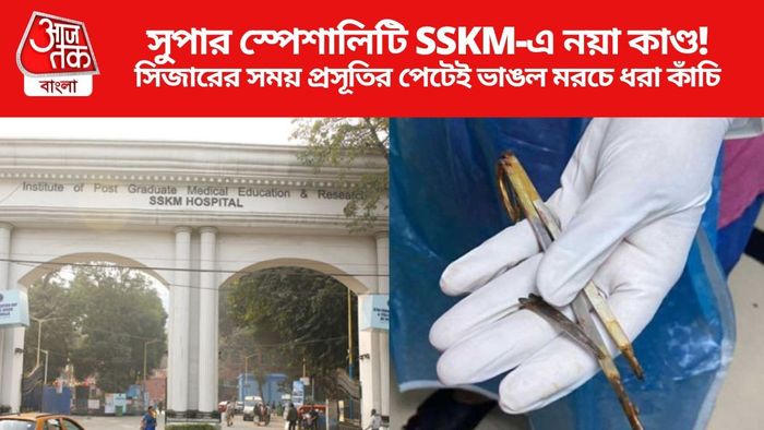 SSKM Hospital Scissor Case