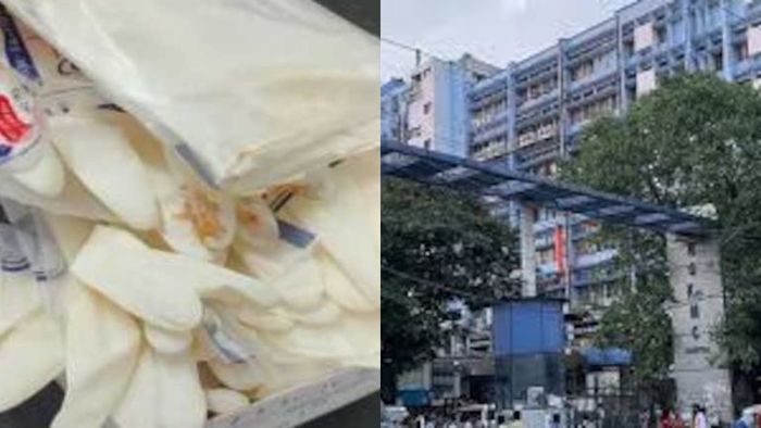 আরজি করে গ্লাভসে দাগ রহস্য।