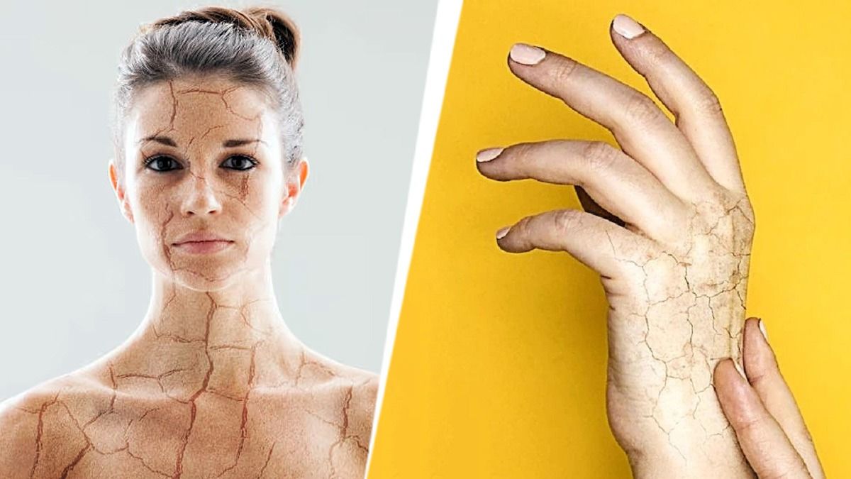 শীতে ত্বকের আর্দ্রতা-সৌন্দর্য দূর হবে না, এভাবে ত্বকের যত্ন নিন 