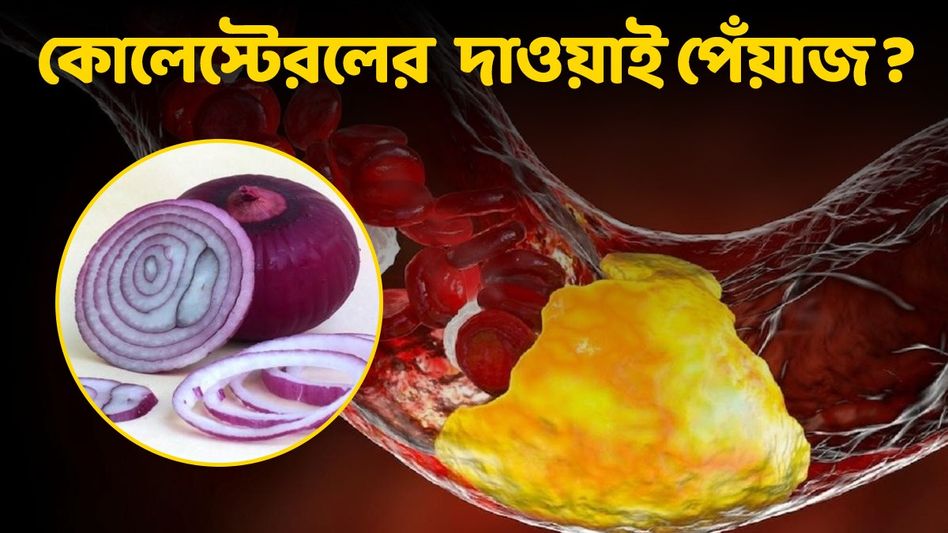 শরীরের উচ্চ কোলেস্টেরল কমবে পেঁয়াজ খেলেই! কীভাবে খেলে সবচেয়ে  বেশি উপকার?  শরীরের উচ্চ কোলেস্টেরল কমবে পেঁয়াজ খেলেই! কীভাবে খেলে সবচেয়ে  বেশি উপকার?