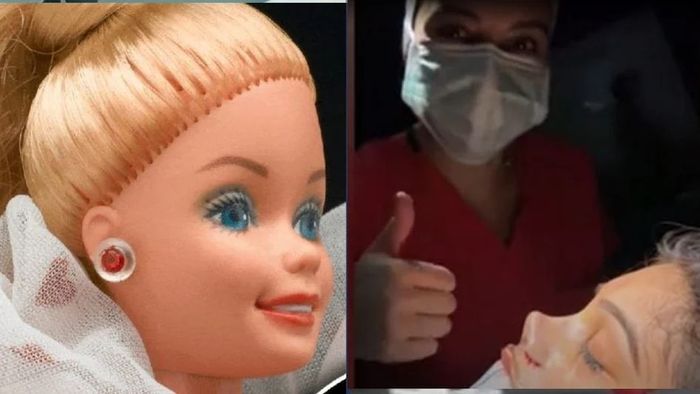 বার্বি ডলের মতো নাকের স্বপ্ন ছিল, সার্জারিতে বদলে গেল চেহারা, দেখুন