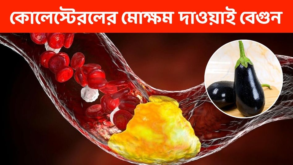 বেগুনেই কাবু হবে শরীরের খারাপ কোলেস্টেরল! এভাবে খেলেই উপকার বেগুনেই কাবু হবে শরীরের খারাপ কোলেস্টেরল! এভাবে খেলেই উপকার