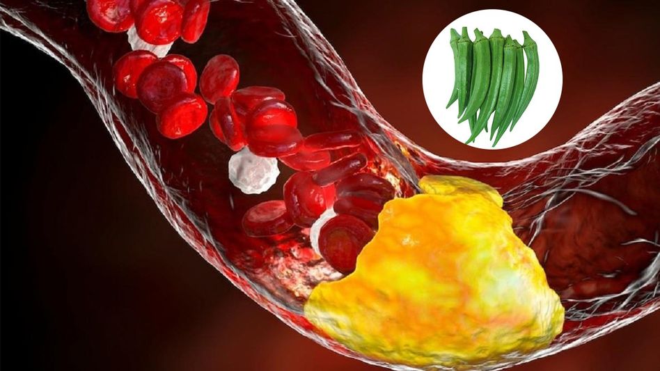 ঢ্যাঁড়শেই কাবু হবে শরীরের খারাপ কোলেস্টেরল! এভাবে খেলেই উপকার  ঢ্যাঁড়শেই কাবু হবে শরীরের খারাপ কোলেস্টেরল! এভাবে খেলেই উপকার