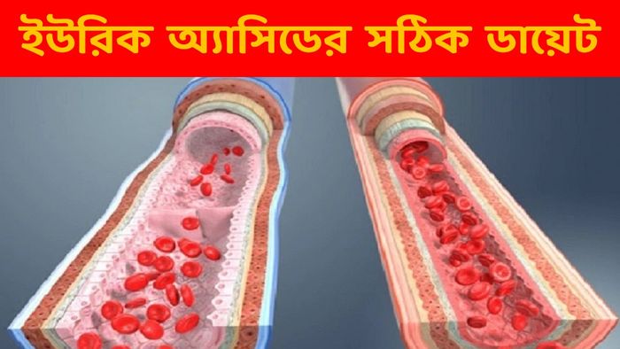 ইউরিক অ্যাসিডের ডায়েট