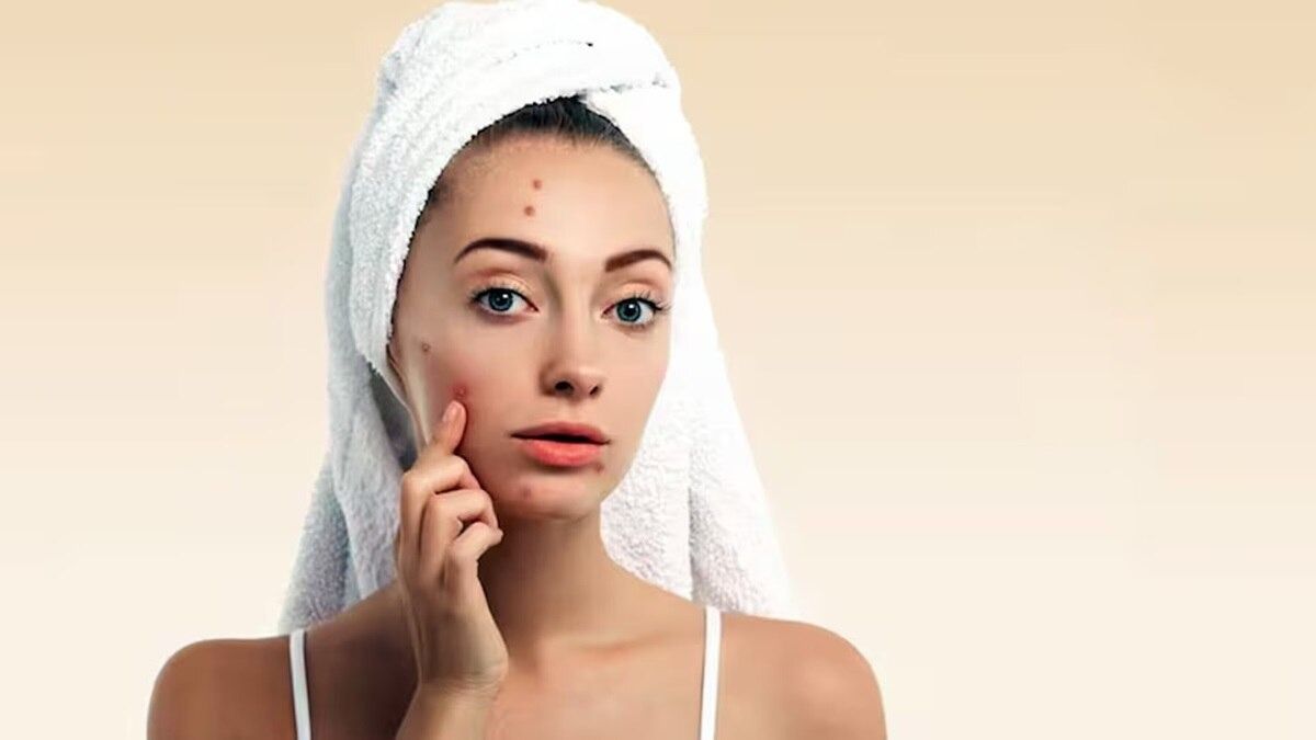 রাতে ঘুমের আগে করা এই ভুলে হতে পারে ব্রণ! সুন্দর- সুস্থ ত্বক পেতে যা করবেন...  