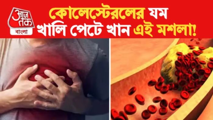 ঘরে থাকা এই ৪ মশলাতে কোলেস্টেরল হুড়মুড়িয়ে গলে যাবে