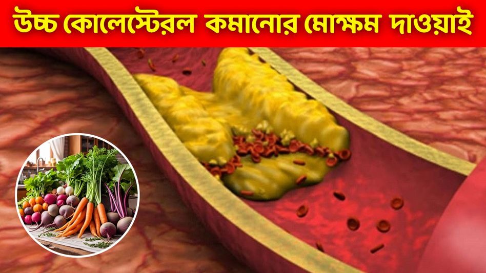 শরীরের খারাপ কোলেস্টেরল গায়েব হবে এসব সবজি খেলেই, কীভাবে খাবেন?  শরীরের খারাপ কোলেস্টেরল গায়েব হবে এসব সবজি খেলেই, কীভাবে খাবেন?