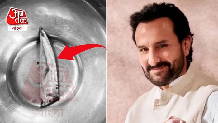 শিরদাঁড়ার ২ মিমি দূরে ছুরির কোপ, সইফকে 'খুব ভাগ্যবান' বললেন ডাক্তাররা