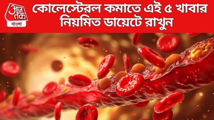 কোলেস্টেরল কমাতে এই ৫ খাবার নিয়মিত ডায়েটে রাখুন