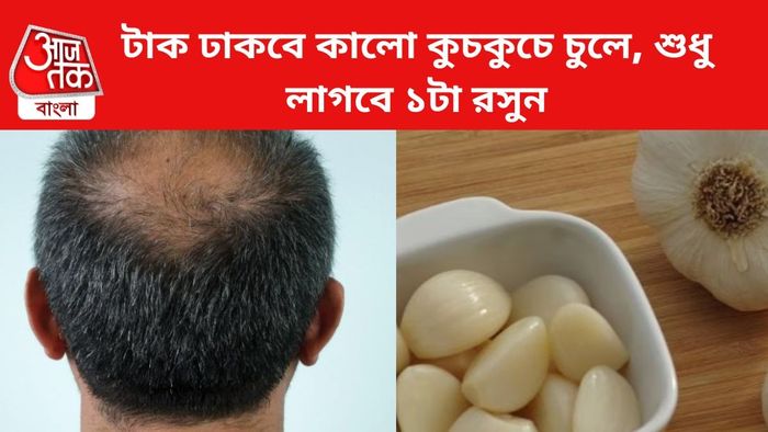 চুলের জন্য কার্যকরী রসুন।