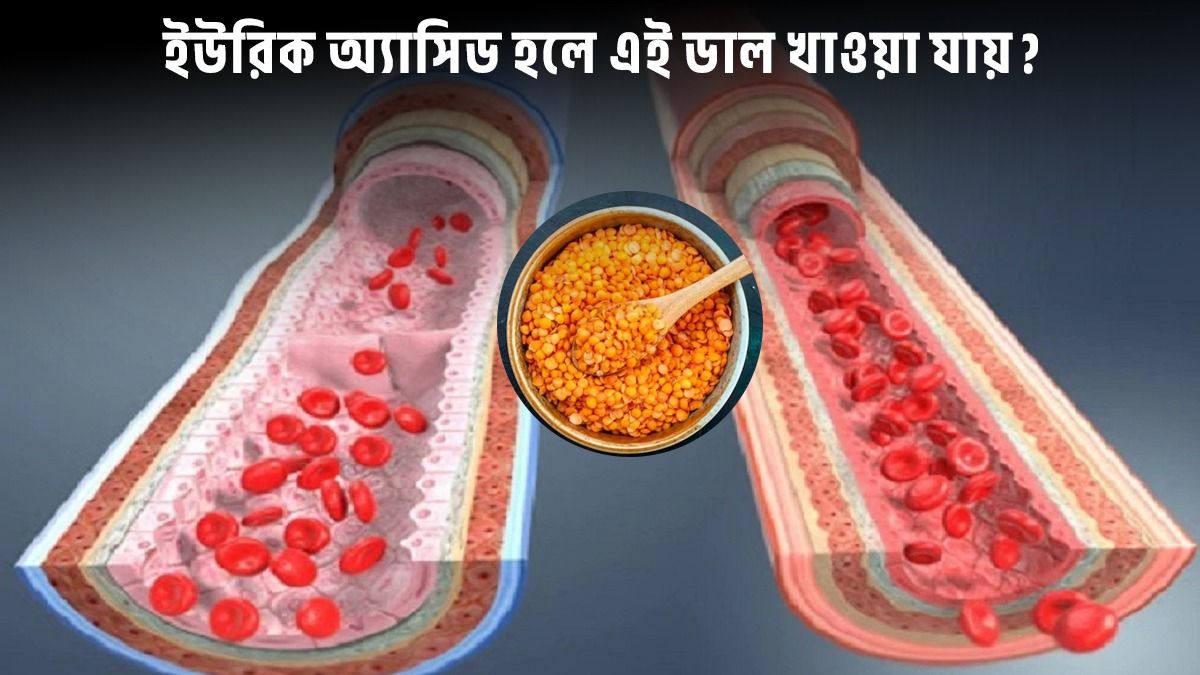 Ukraina erotik modellari