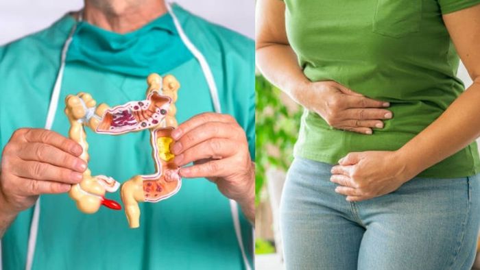 অ্যাপেন্ডিসাইটিস কেন হয়? জেনে নিন উপসর্গ ও প্রতিরোধের উপায়