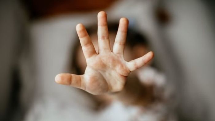 প্রতীকী ছবি