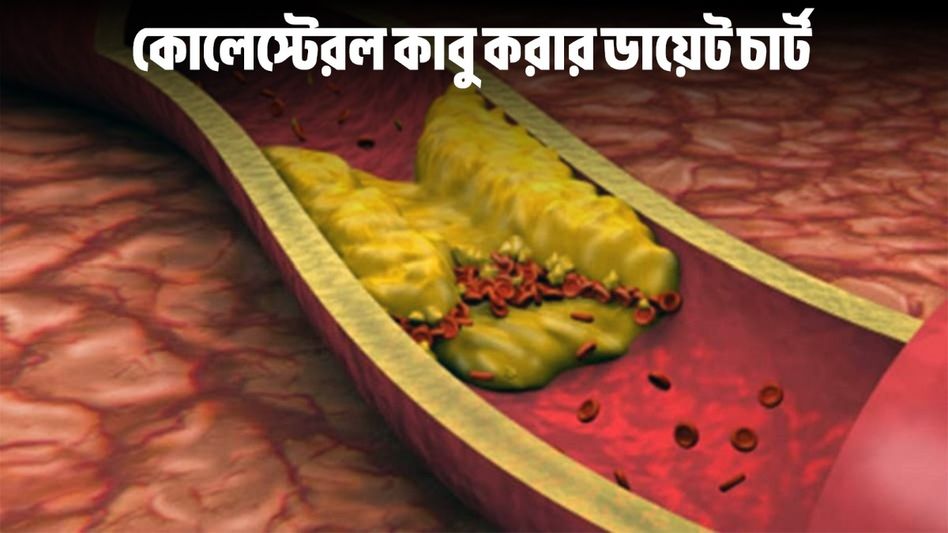 হু হু করে কমবে খারাপ কোলেস্টেরল, সুস্থ থাকতে এসব খান হু হু করে কমবে খারাপ কোলেস্টেরল, সুস্থ থাকতে এসব খান