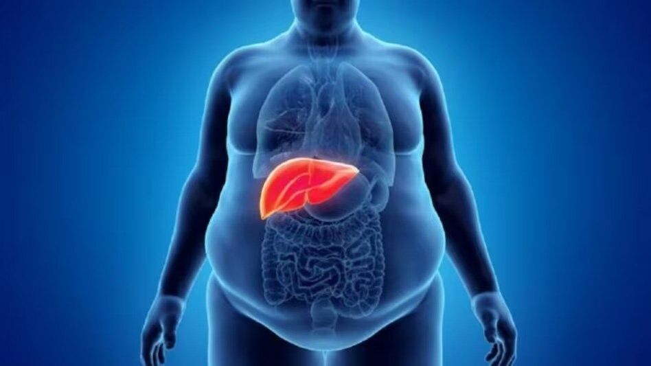 এই ৫ ধরনের খাবার ফ্যাটি লিভারের ঝুঁকি বাড়ায়, সুস্থ থাকতে জানা জরুরি  এই ৫ ধরনের খাবার ফ্যাটি লিভারের ঝুঁকি বাড়ায়, সুস্থ থাকতে জানা জরুরি