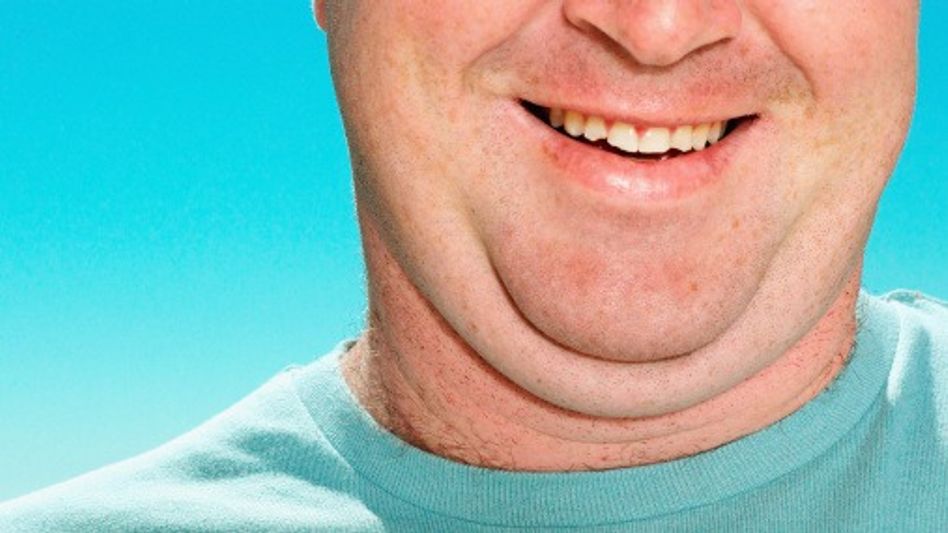 ডাবল চিন- ঘাড়ের মেদ কমবে মাত্র কয়েকটা ব্যায়ামেই, জেনে নিন চটপট ডাবল চিন- ঘাড়ের মেদ কমবে মাত্র কয়েকটা ব্যায়ামেই, জেনে নিন চটপট