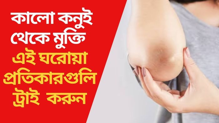 কালো কনুই থেকে মুক্তি