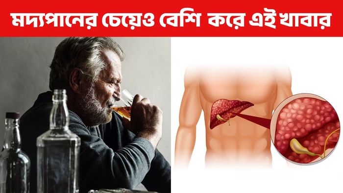 মদপানের চেয়েও লিভার বেশি খারাপ করে এই খাবারগুলি, আমরা রোজ খাই