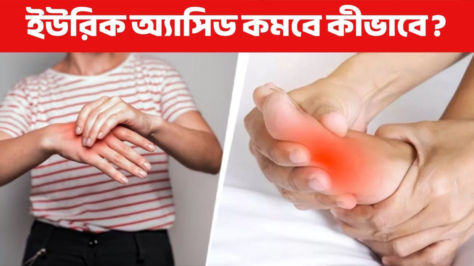 ঘরে বসেই কমবে ইউরিক অ্যাসিডের মাত্রা, শুধু মানতে হবে এই নিয়ম ঘরে বসেই কমবে ইউরিক অ্যাসিডের মাত্রা, শুধু মানতে হবে এই নিয়ম