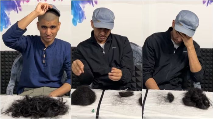 ৫ দিন ধরে মাথার সব চুল গুনলেন এই যুবক, হিসেবে কত হল?