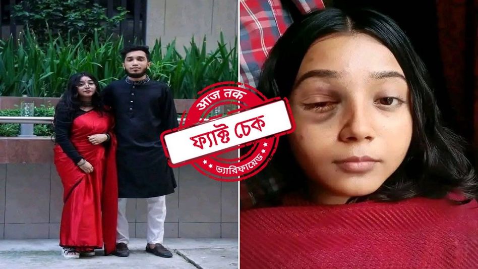 ফ্যাক্ট চেক: লাভ জিহাদের পরিণতি দাবিতে প্রচার মুসলিম যুবতীর দুর্ঘটনার ছবি ফ্যাক্ট চেক: লাভ জিহাদের পরিণতি দাবিতে প্রচার মুসলিম যুবতীর দুর্ঘটনার ছবি
