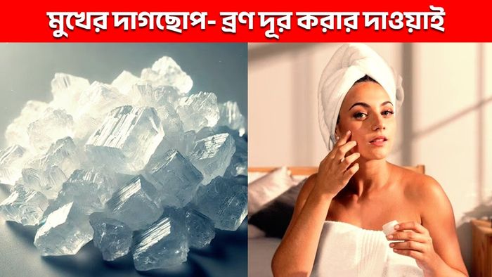 প্রতীকী ছবি