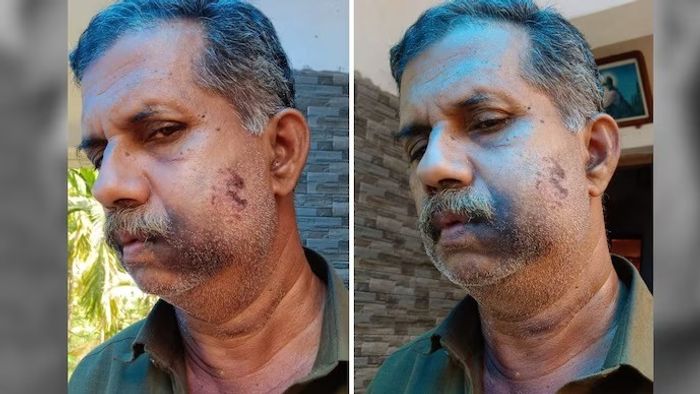 Kerala Man beaten