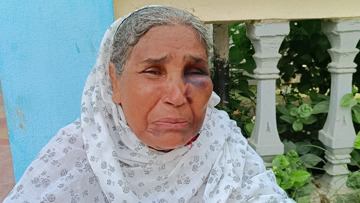 আক্রান্ত বৃদ্ধা