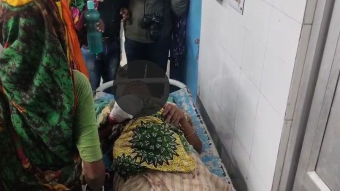 নন্দীগ্রামে বিস্ফোরণ, পাটের সুতো টানতেই ধামাকা, আহত মহিলা