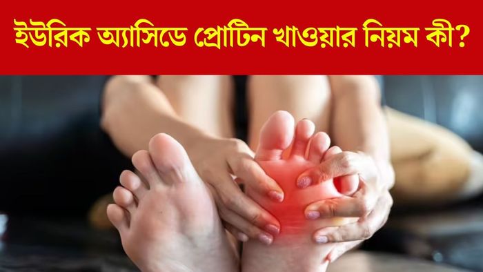 ইউরিক অ্যাসিড