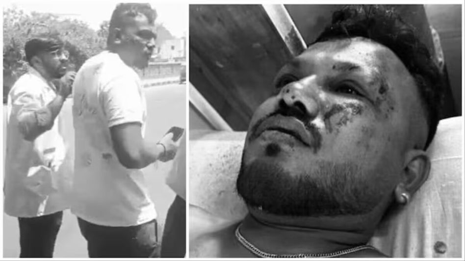 ঘুম আসে না-কথাও বলেন না কারও সঙ্গে; গুম মেরে আছেন আহমেদাবাদ বিমান দুর্ঘটনার একমাত্র জীবিত ব্যক্তি ঘুম আসে না-কথাও বলেন না কারও সঙ্গে; গুম মেরে আছেন আহমেদাবাদ বিমান দুর্ঘটনার একমাত্র জীবিত ব্যক্তি