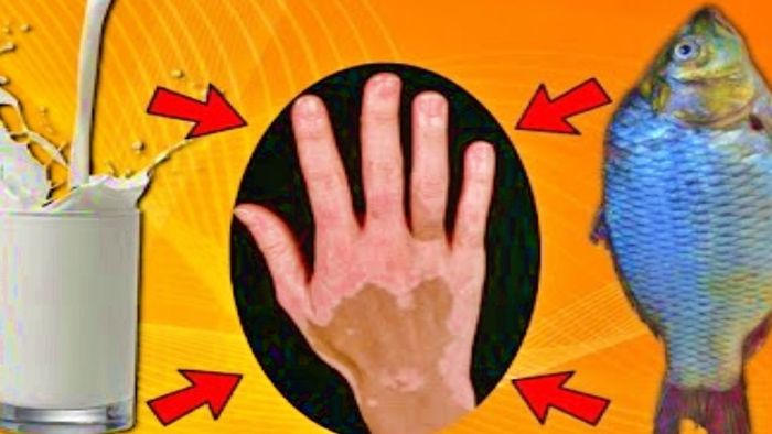 মাছ ও দুধ একসঙ্গে খেলে কী হয়?