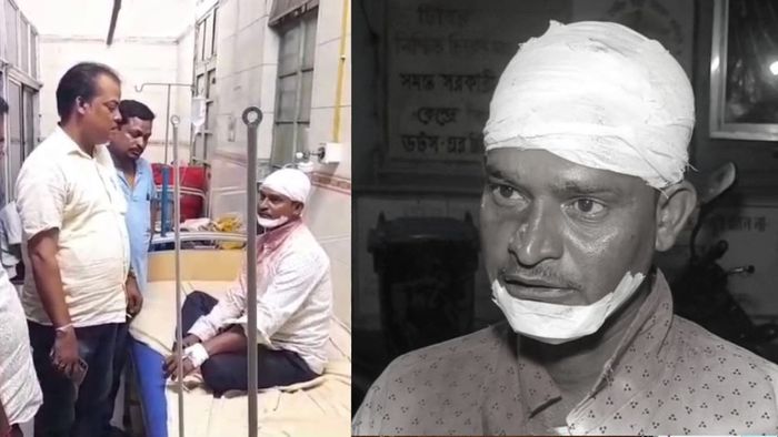 শহিদ সমাবেশে যেতে গিয়ে আক্রান্ত তৃণমূল কর্মী।