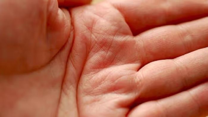 হাতে আছে এই চিহ্ন? ৪০ বছর বয়সের পর চকমক করে উঠবে কপাল