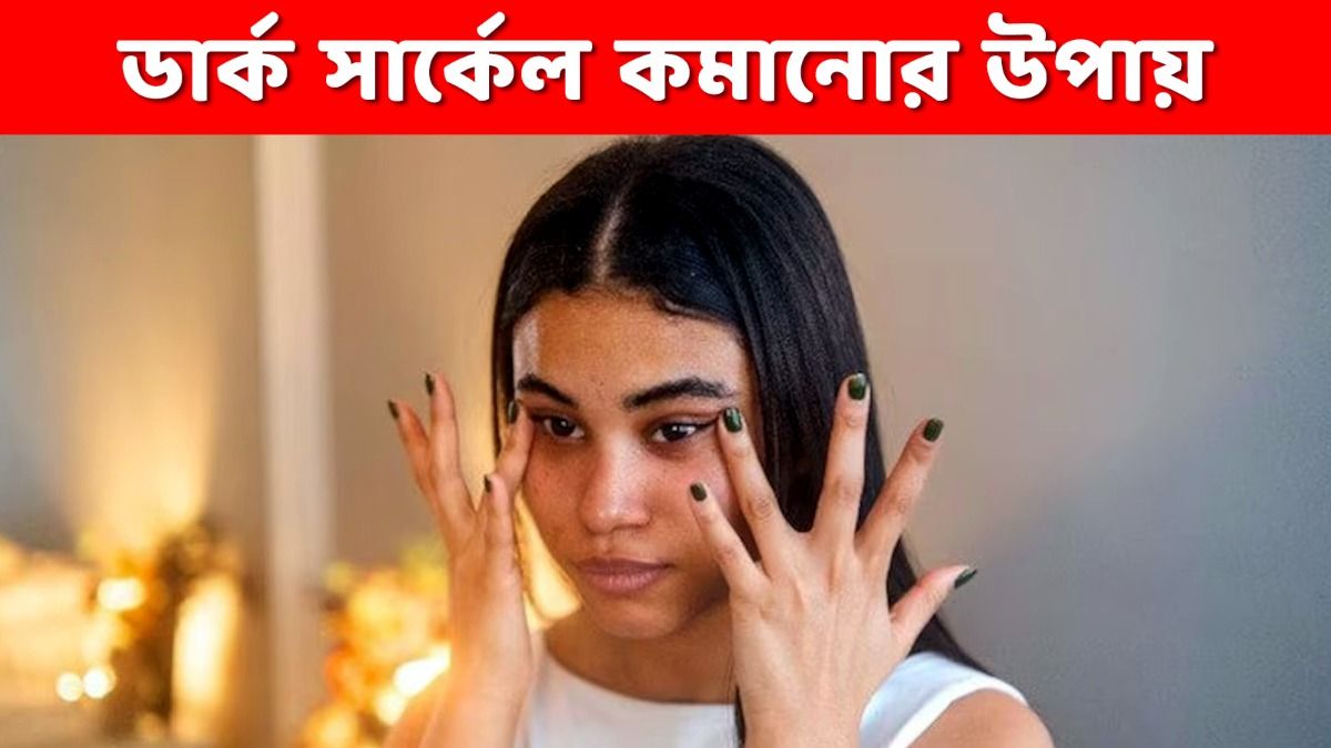 চোখের নিচে ডার্ক সার্কেল আছে? এসব ঘরোয়া টোটকায় মিলবে সমাধান