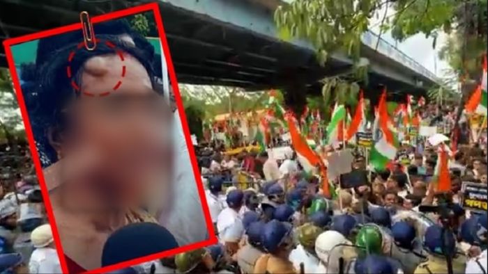 নবান্ন অভিযানে আহত নির্যাতিতার মা