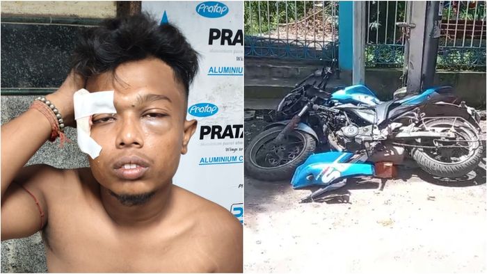 আহত যুবক।-ফাইল ছবি