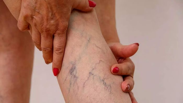 পায়ে ফুটে উঠছে নীল শিরা, খুব সাবধান! গুরুতর সমস্যার লক্ষণ