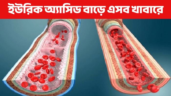 ইউরিক অ্যাসিড